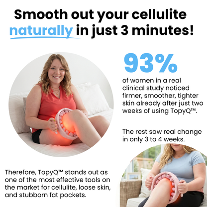 TopyQ™  Cellulite Roller–Patented Ergonomic Anti-Cellulite Massager
