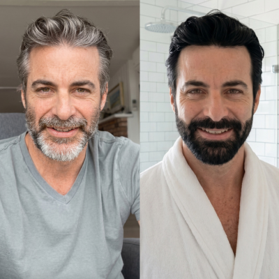 Before and after result