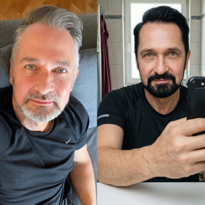 Before and after result